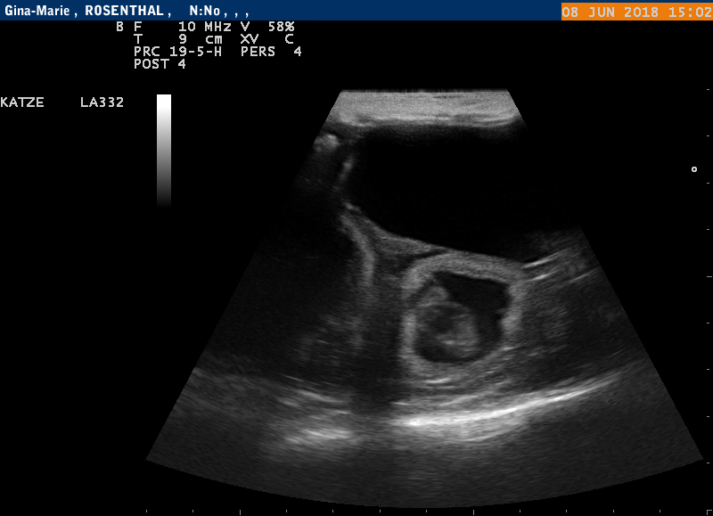 Tr&auml;chtigkeitsultraschall