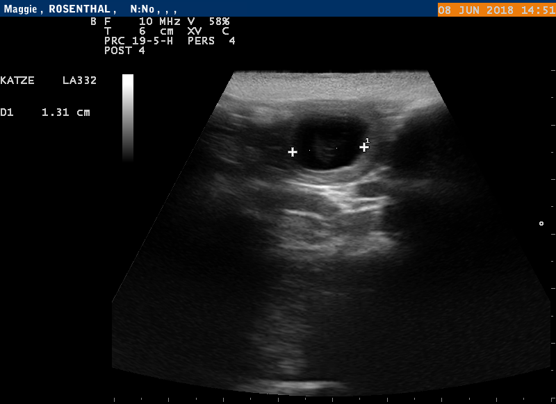 Tr&auml;chtigkeitsultraschall