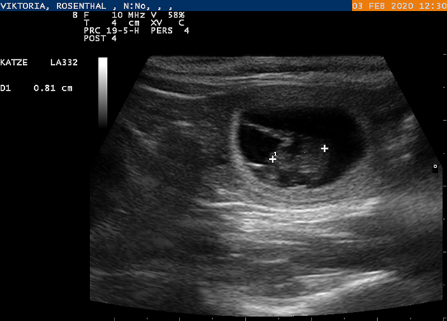 Tr&auml;chtigkeitsultraschall