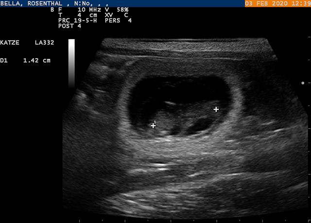 Tr&auml;chtigkeitsultraschall